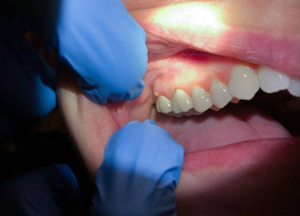 Best Emergency Treatment for Toothache in Vandenberg Af, CA