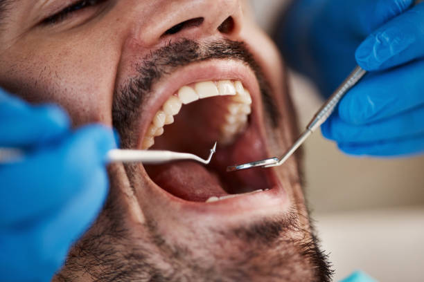 Best Emergency Broken Tooth Repair in Vandenberg Af, CA
