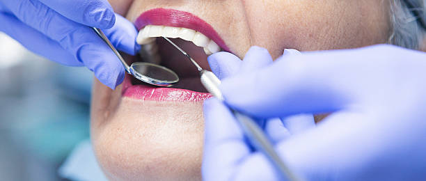 Best Emergency Wisdom Teeth Removal in Vandenberg Af, CA